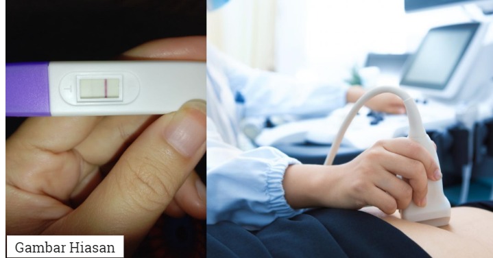 Kenapa Ujian Kehamilan Penting Kenapa Tak Buat Ultrasound Terus Jika Wanita Ada Masalah Di Bahagian Perut Atau Haid Lambat Ini Penjelasan Doktor