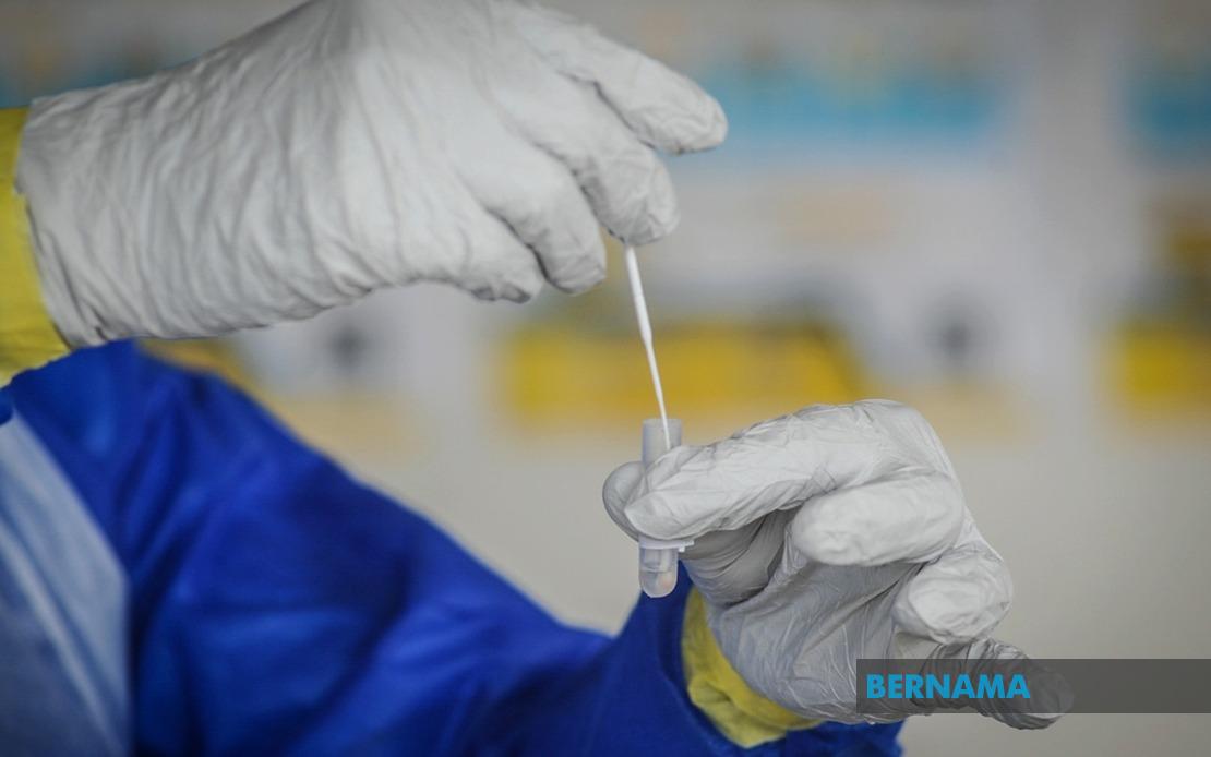 Dua Kit Ujian Kendiri Covid19 Dapat Kelulusan Bersyarat KKM